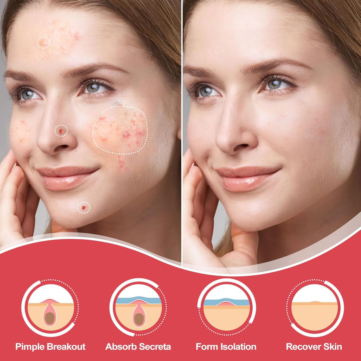 Pimple Patches for Face, Acne Patches Spot Treatment Patch
