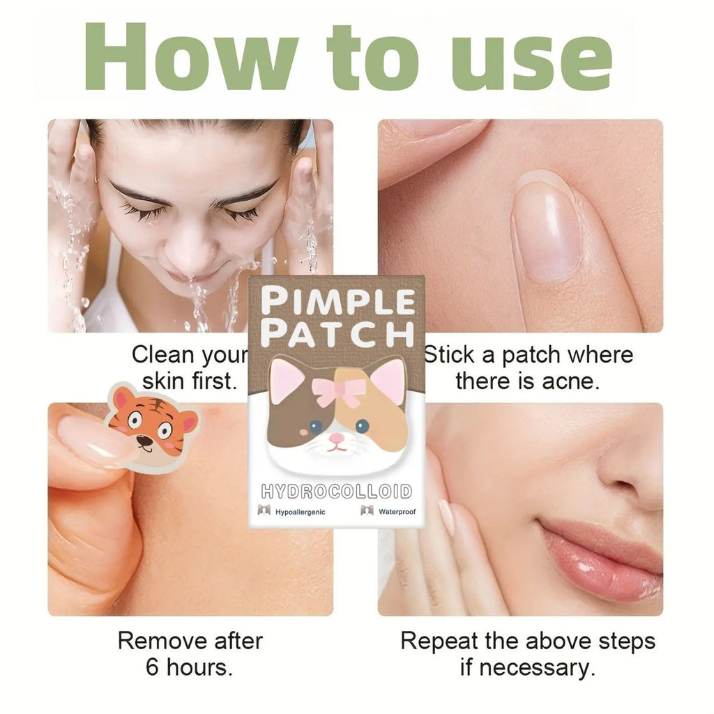 600Pcs Hydrocolloid Acne Patches, Acne Pimple Patch, Daily Covering Stickers for Face & Skin Care, Swollen Acne Removal Products, Single Pack #GLOBAL PICKS