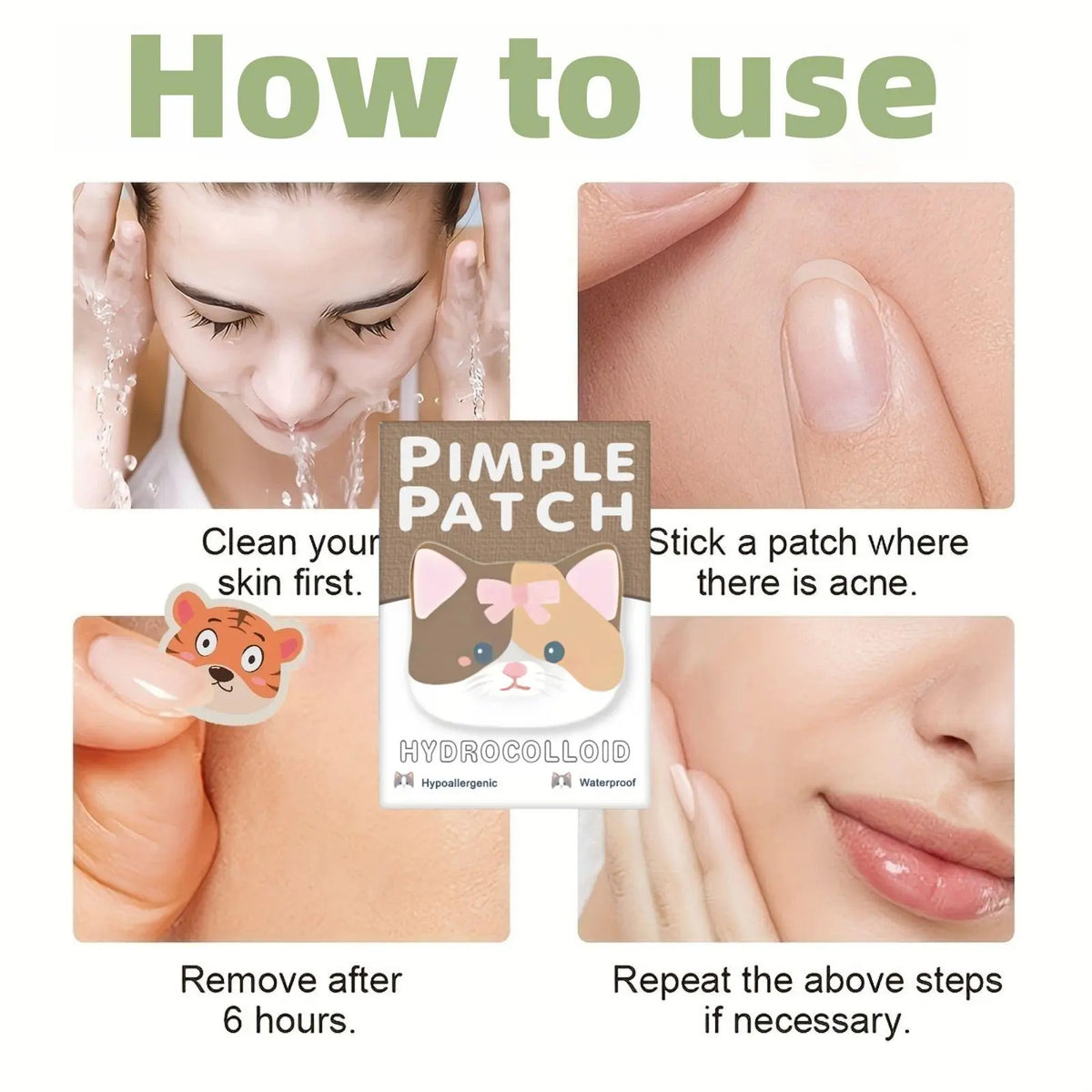600Pcs Hydrocolloid Acne Patches, Acne Pimple Patch, Daily Covering Stickers for Face & Skin Care, Swollen Acne Removal Products, Single Pack #GLOBAL PICKS