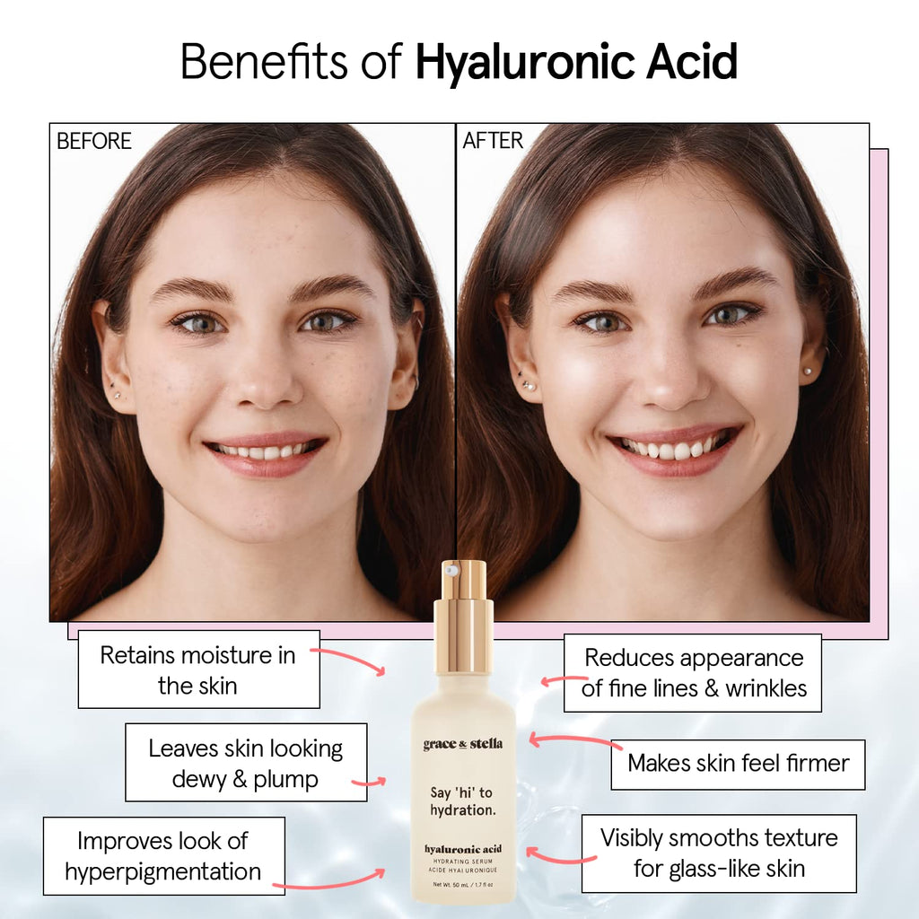 Hyaluronic Acid Serum for Face Remove Fine Lines, Wrinkles, anti Aging