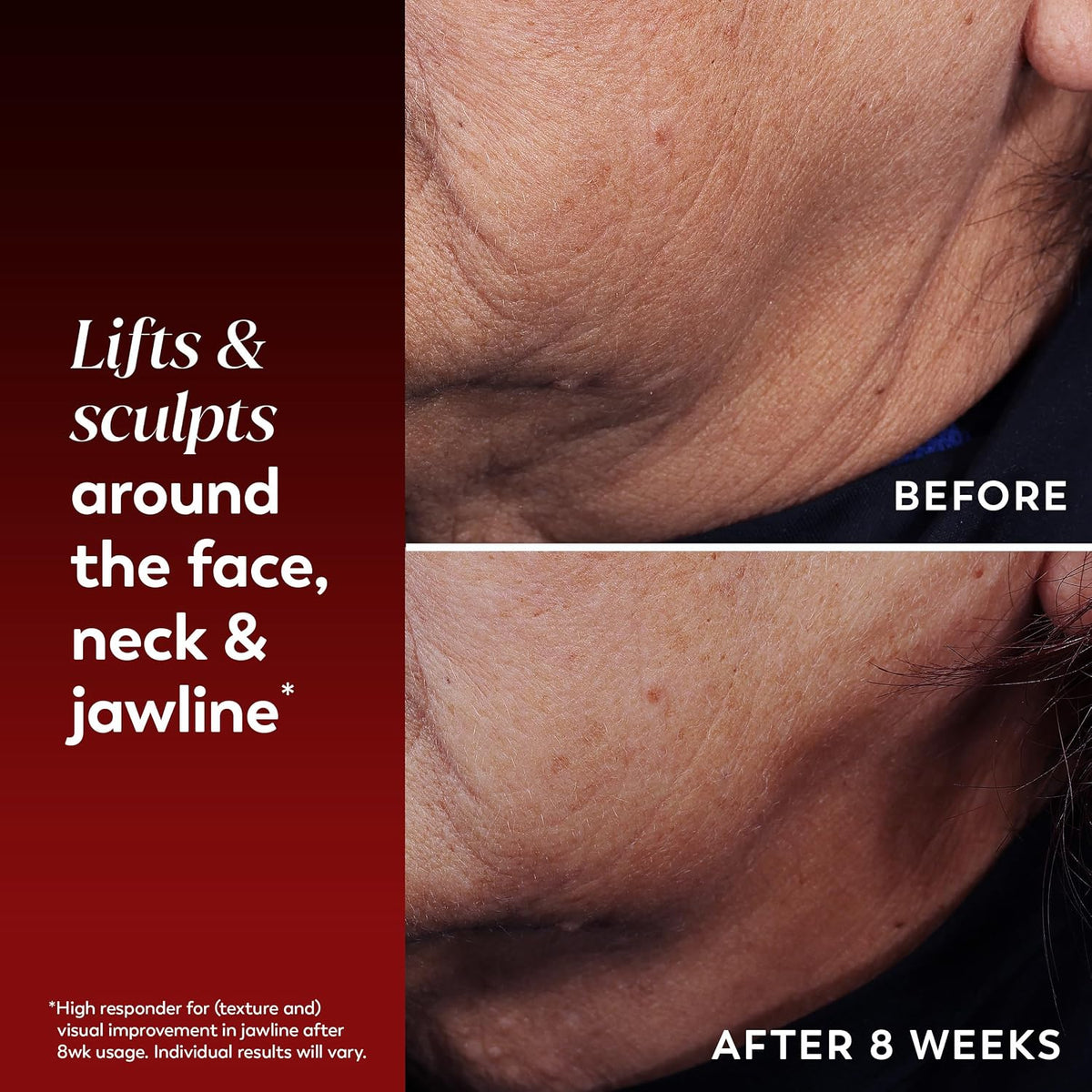 Neck Cream for Tightening and Firming, Anti-Aging Moisturizer for Women, Anti-Wrinkle Serum