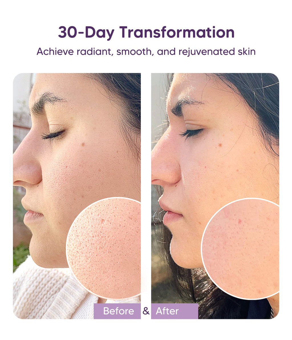 Dreamy Mango Niacinamide Serum